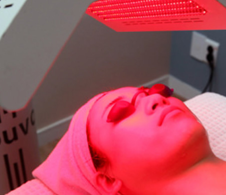 ヒーライトレーザーの照射